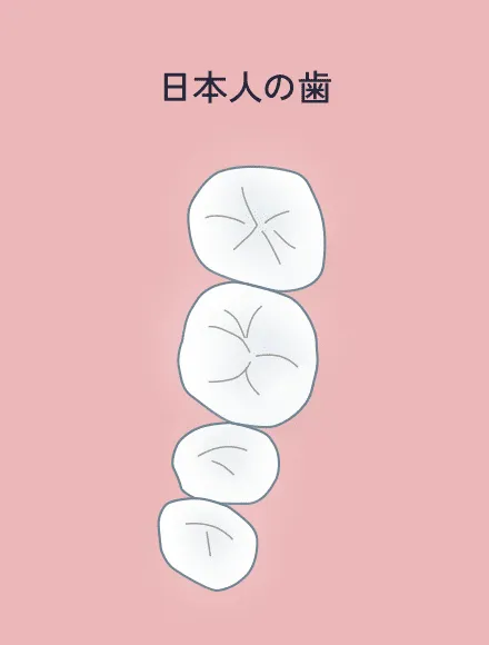 日本人の歯